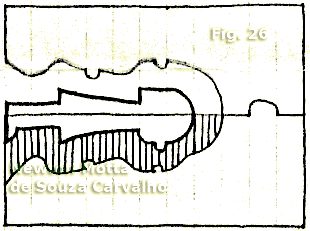 Figura 26  Recolocar o gesso.